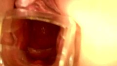 Speculum babe fisting her tight pussy 😍