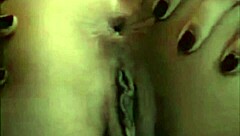 In a casual tale, the asshole blinks playfully.