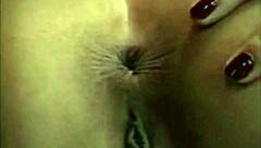 In a casual tale, the asshole blinks playfully.