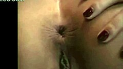 In a casual tale, the asshole blinks playfully.