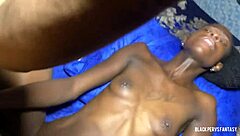 This rehab patient ends up getting her ebony ass fucked hard by big black cock while pussy gets dug open