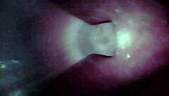 An endoscope camera records the close-up view of male ejaculation in real time.