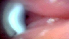 An endoscope camera records the close-up view of male ejaculation in real time.