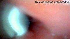 An endoscope camera records the close-up view of male ejaculation in real time.