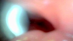 An endoscope camera records the close-up view of male ejaculation in real time.